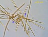 Anabaenopsis elenkinii V. Miller